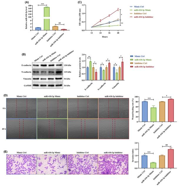 (A) The expression level of miR-410-3p in HTR-8 cells transfected with miR-410-3p mimic or inhibitor was measured by RT-PCR. (B) The expression levels of E-cadherin, N-cadherin, and vimentin protein in HTR-8 cells transfected with miR-410-3p mimic or inhibitor were detected by western blotting. (C) Proliferation capacity in HTR-8 cells transfected with miR-410-3p mimic or inhibitor was detected by CCK-8 assay. (D, E) Migration and invasion capacities in HTR-8 cells transfected with miR-410-3p mimic or inhibitor were determined by scratch wound healing and transwell assays, respectively.