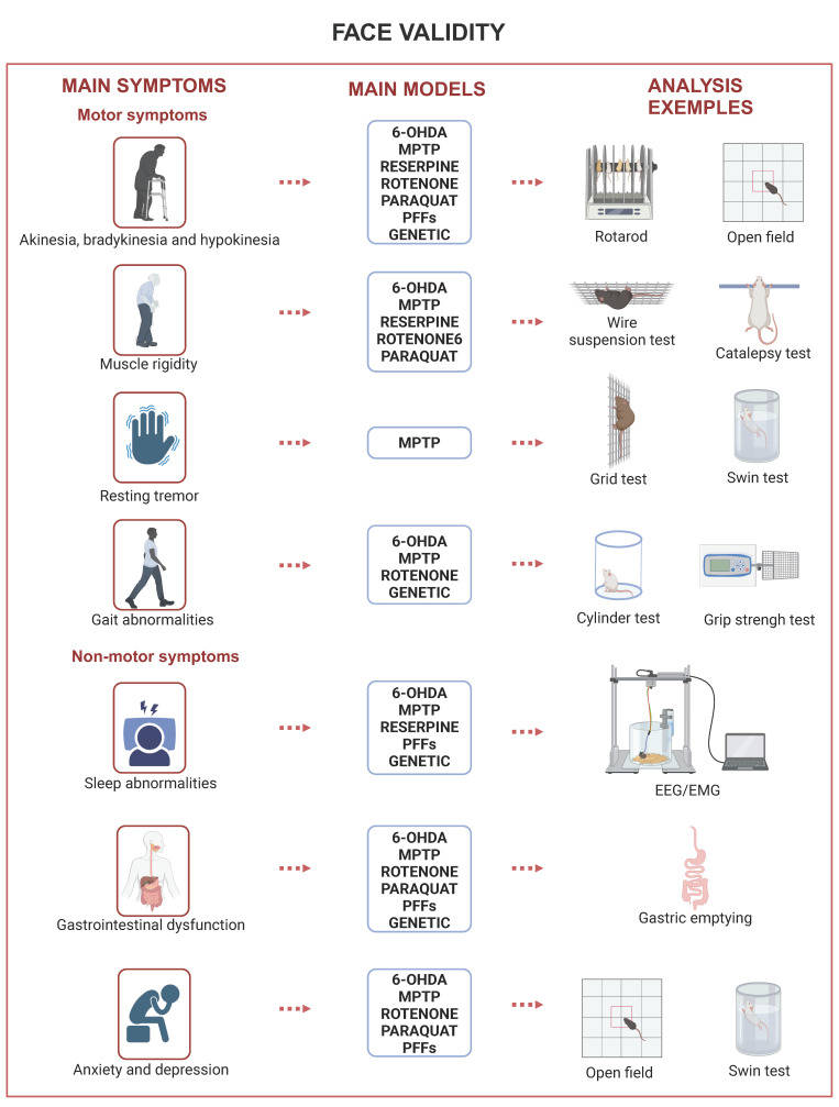 Main symptoms of Parkinson's disease.