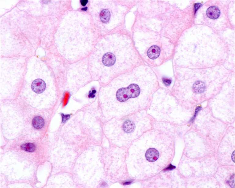 Hepatocytes.