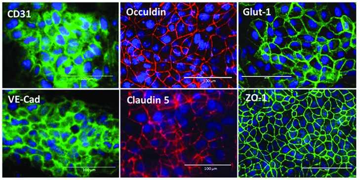 Immunofluorescent staining was conducted on BMEC marker proteins, which include adherence junction proteins (CD31, VE-cadherin), tight junction proteins (Occludin, claudin 5, ZO-1), and the glucose transporter Glut-1. Scale bars represent 100 µm.