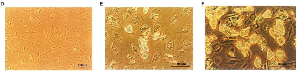 Proliferation and differentiation of human primary preadipocytes are observed. (D) Human preadipocytes at Day 8 (×100 magnification). Adipocytes shown on Day 10 (E) and Day 18 (F) following differentiation induction.