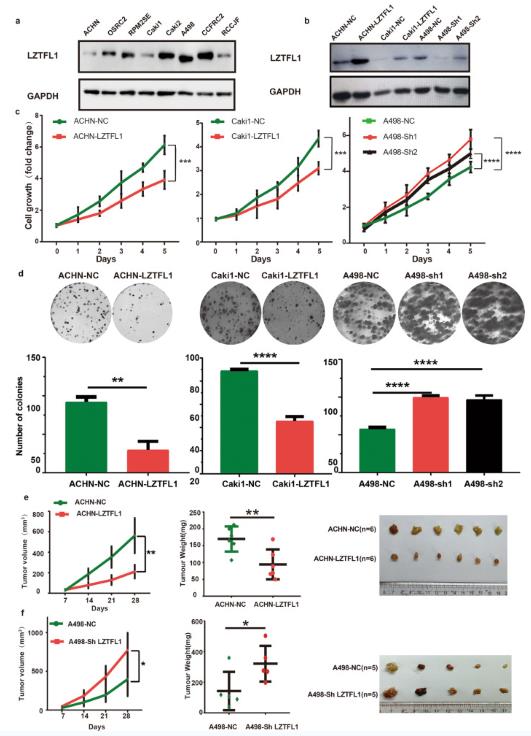 A Western blots of the endogenous LZTFL1 in various ccRCC cell lines. b Western blots of LZTFL1 in ACHN and Caki1 cell lines transduced with lentiviruses expressing control vector (ACHN-NC, caki1-NC) or LZTFL1 (ACHN-LZTFL1, Caki1-LZTFL1), and in A498 cell line transduced with lentiviruses expressing control (A498-NC) or two different LZTFL1 shRNAs (A498-sh1 & A498-sh2). c Relative cell growth of ccRCC cell lines with control, LZTFL1-overexpressed or knocked down as indicated. d Colony-forming ability of ccRCC cells with control, LZTFL1-overexpressed or knocked down as indicated. e, f 5 × 106 cells with LZTFL1 overexpressed (e), knockdown (f), or corresponding control vectors were inoculated subcutaneously into the mice.