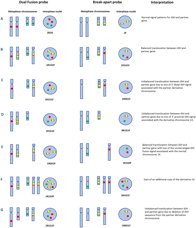 For each probe set the partner gene metaphase chromosome is in the left ideogram and chromosome 14 is in the right ideogram. For the dual fusion probes, the IGH locus is green, and partner genes are red and yellow representing fusion signals resulting from a translocation. For the break-apart probes, the 5′ distal IGH sequences are green, the 3′ proximal IGH sequences are green, and fusion signals are yellow (normal unrearranged IGH loci).