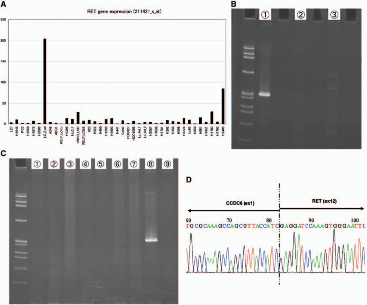 A, Bar graphs of gene-level expressions of RET in the 39 cell lines. B, Results for fusion-specific RT-PCR of LC-2/ad. C, RET-CCDC6 fusion was captured only in LC-2/ad and was not captured in any of the other cell lines tested. D, Direct sequencing of the PCR product containing RET-CCDC6 fusion.