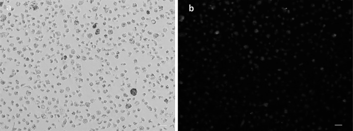 a. M-07e cells before the transfection, b. M-07e cells after the transfection and images of the same field of M-07e cells demonstrate that the majority of cells are transfected.