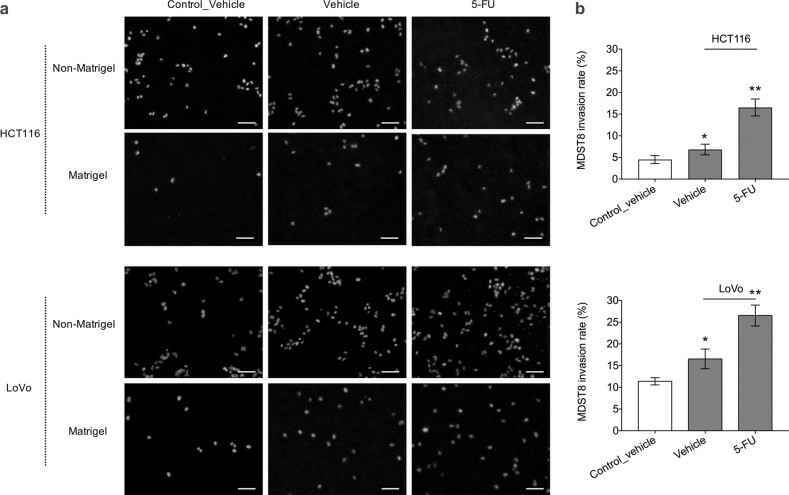 a Representative widefield fluorescence microscopy images showing MDST8 migration and invasion through transwell membrane with and without Matrigel coating after 2 days of exposure to HCT116 or LoVo in the bottom wells. b Invasion rate of MDST8 presented as the percentage of cell invasion through Matrigel-coated transwell membrane relative to the cell migration through the non-Matrigel-coated transwell membrane.