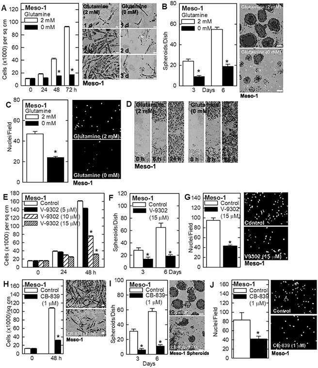 A/B Meso-1 cells were grown as monolayer cultures in regular cell culture dishes or as cancer stem-like cell-enriched spheroids in ultra-low attachment dishes. C/D Absence of glutamine reduces Meso-1 cell invasion through matrigel and wound closure. E/F/G Treatment with the glutamine transporter inhibitor, V-9302, reduces Meso-1 cell growth, spheroid formation, and invasion. H/I/J Treatment with the glutaminase (GLS) inhibitor, CB-839, reduces Meso-1 cell growth, spheroid formation, and cell invasion.