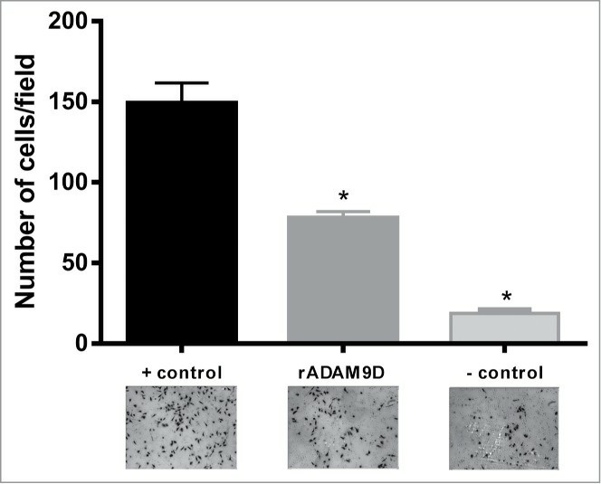 DU145 cells (1.25 × 105 cells/ml) were seeded on the inserts (12 well-plate) of the invasion chamber in the presence or absence of rADAM9D (1 µM). A complete medium was used as a chemoattractant at the lower chamber. Plates were incubated for 22 h at 37°C and 5% CO2. Non-invading cells were removed with a cotton swab from the upper surface of the membrane invading cells were fixed 10 random fields from microscope slides were photographed and cells were counted using Image J software.