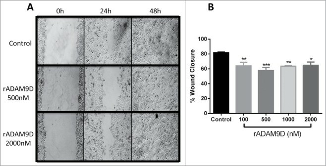 rADAM9D inhibits the migration of DU145 cells in a wound healing assay.