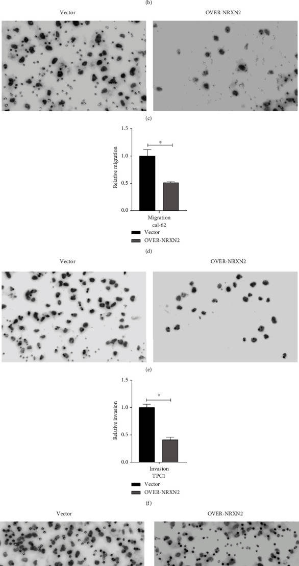 NRXN2 decreased cell metastasis in THCA cells.