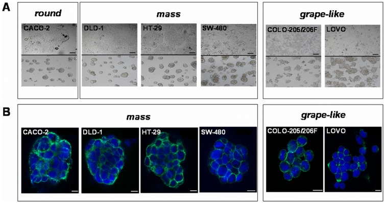 (A) Growth morphology of CRC cell lines cultivated under 2D (upper panel) and lrECM 3D on-top assay conditions (lower panel). Cells cultivated in 3D condition either show a round (CACO-2), mass (DLD-1, HT-29, SW-480) or a grape-like morphology (COLO 205, COLO-206F, LOVO) in phase contrast images. (B) Confocal laser scanning fluorescence microscopy images of CRC spheroids.