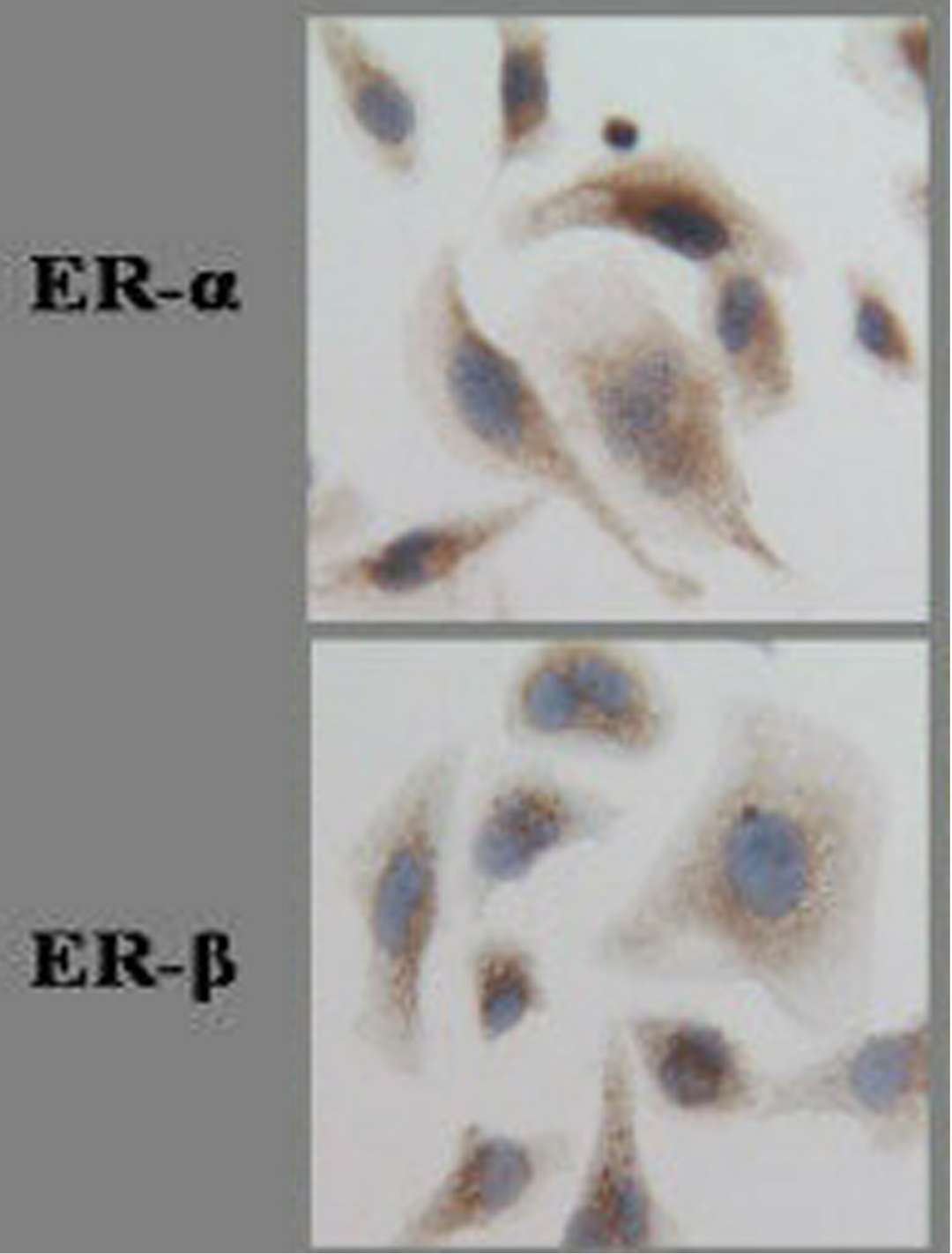 Immunocytochemical staining of ER-alpha and ER-beta in EFO-21 cells.