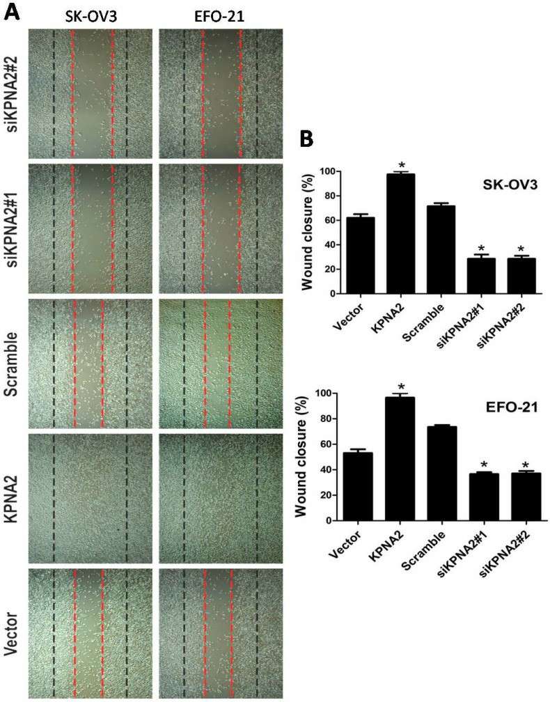 Impact of KPNA2 on the motility of epithelial ovarian carcinoma (EOC) cells.