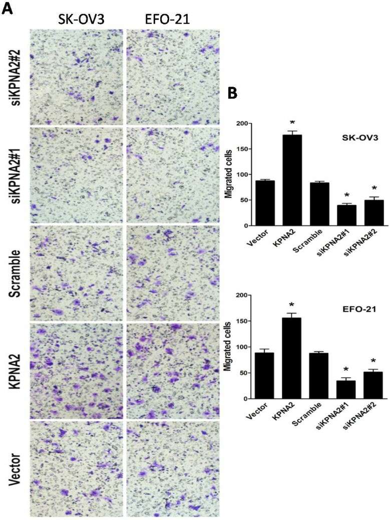 Influence of KPNA2 on the invasiveness of EOC cells.