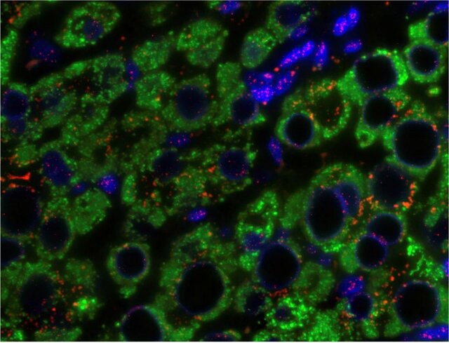 Application of Q-FISH in liver tissues of chronic HBV infection.