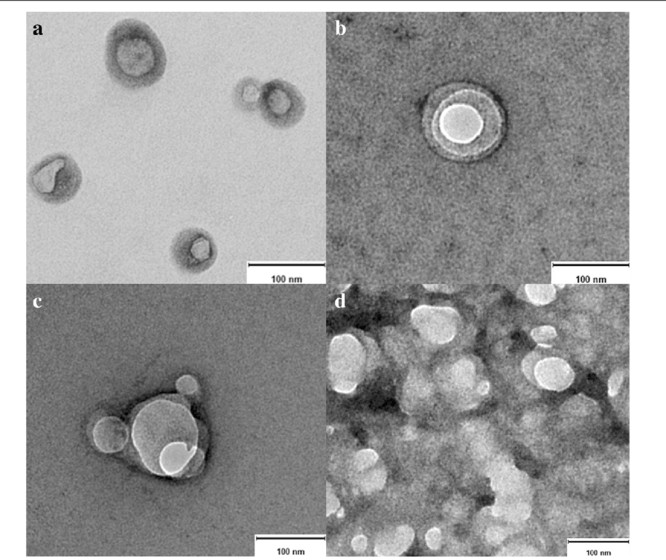 NTA detection of native exosomes.