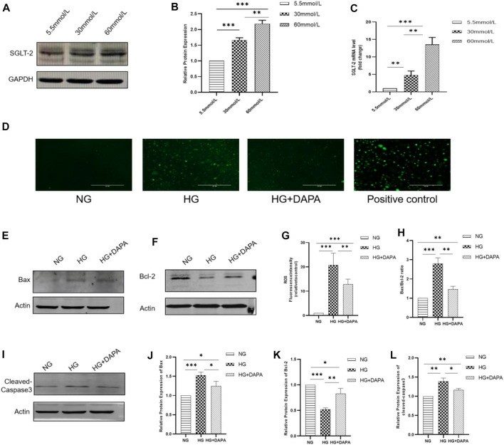 Expression of SGLT-2 in HRMECs, along with the impact of DAPA on ROS levels and apoptosis in these cells.