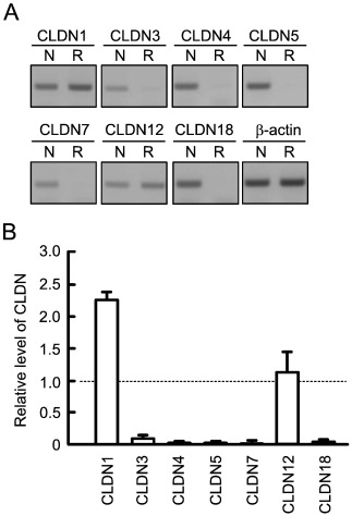 Total RNAs from human normal lung (N) and RERF-LC-AI cells (R) were used as templates. (A) Semi-quantitative PCR was performed using primers as indicated. (B) Quantitative real-time PCR was performed using primers as indicated.