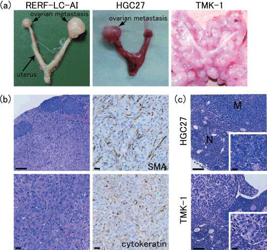 (a) Macroscopic findings of mouse ovarian tumors. Transevenous inoculation of RERF‐LC‐AI and intraperitoneal inoculation (i.p.) of HGC27 caused bilateral and unilateral enlargement of the ovaries, respectively. In the i.p. experiment of TMK‐1, the ovaries were entirely buried in the disseminated tumor. (b) Histology and immunohistochemistry (smooth muscle actin [SMA] and human-specific cytokeratin) of mouse ovarian tumors of RERF‐LC‐AI. (c) Histology of ovarian tumors established by i.p. of HGC27 and TMK-1.