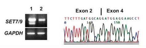 Longer RT-PCR of SET7/9 exons 1-8 in TGBC11TKB and KATO-III cells (left). After the subcloning of the RT-PCR product showing an abnormal SET7/9 transcript in TGBC11TKB cells, sequencing was performed (right).