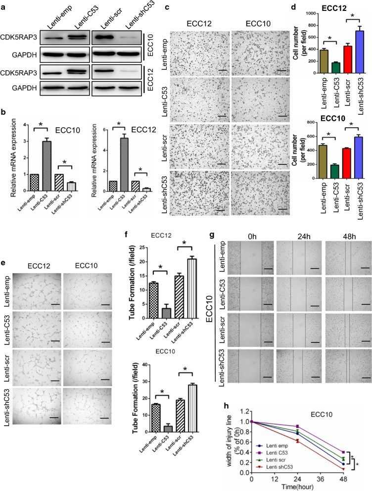 (a) CDK5RAP3 expression changes were confirmed using western blot analysis. CDK5RAP3 mRNA changes were confirmed using RT-PCR. (b) CDK5RAP3 inhibits tumor-induced HUVEC migration as shown by transwell migration assays. Representative images are shown under high-power fields (10×) (c). Quantification of results is presented in (d). CDK5RAP3 inhibits tumor-induced HUVEC angiogenesis as shown by tube formation assays. Representative images are shown under high-power fields (10×) (e). Quantification of the results is presented in (f). CDK5RAP3 in ECC10 cells indirectly inhibits tumor-induced HUVEC migration as shown by wound healing assay. Representative images are shown under high-power fields (10×) (g). Quantification of results is presented in (h).