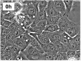 EGI-1 cells.