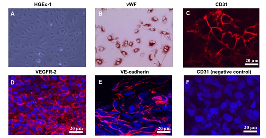 Characterization of the human glomerular endothelial cell line.