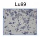 Lu99 cell motility