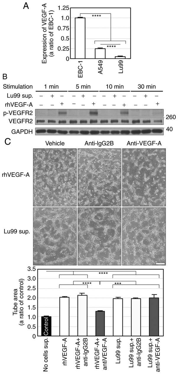 (A) Lu99 cells barely express VEGF-A mRNA. (B) VEGFR2 phosphorylation is not induced by the Lu99 supernatant. (C) VEGF-A neutralization failed to suppress Lu99 supernatant-induced tube formation.