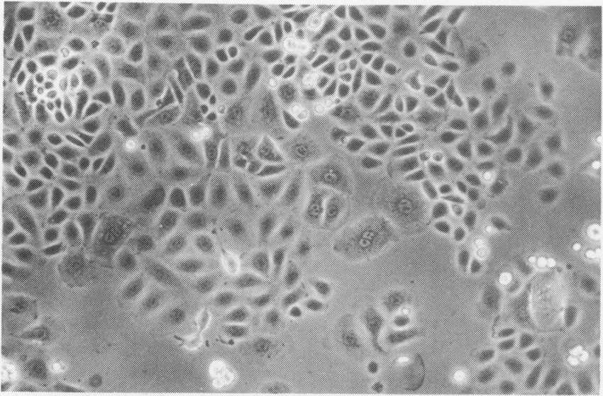 CAL51 cell line’s photomicrograph.