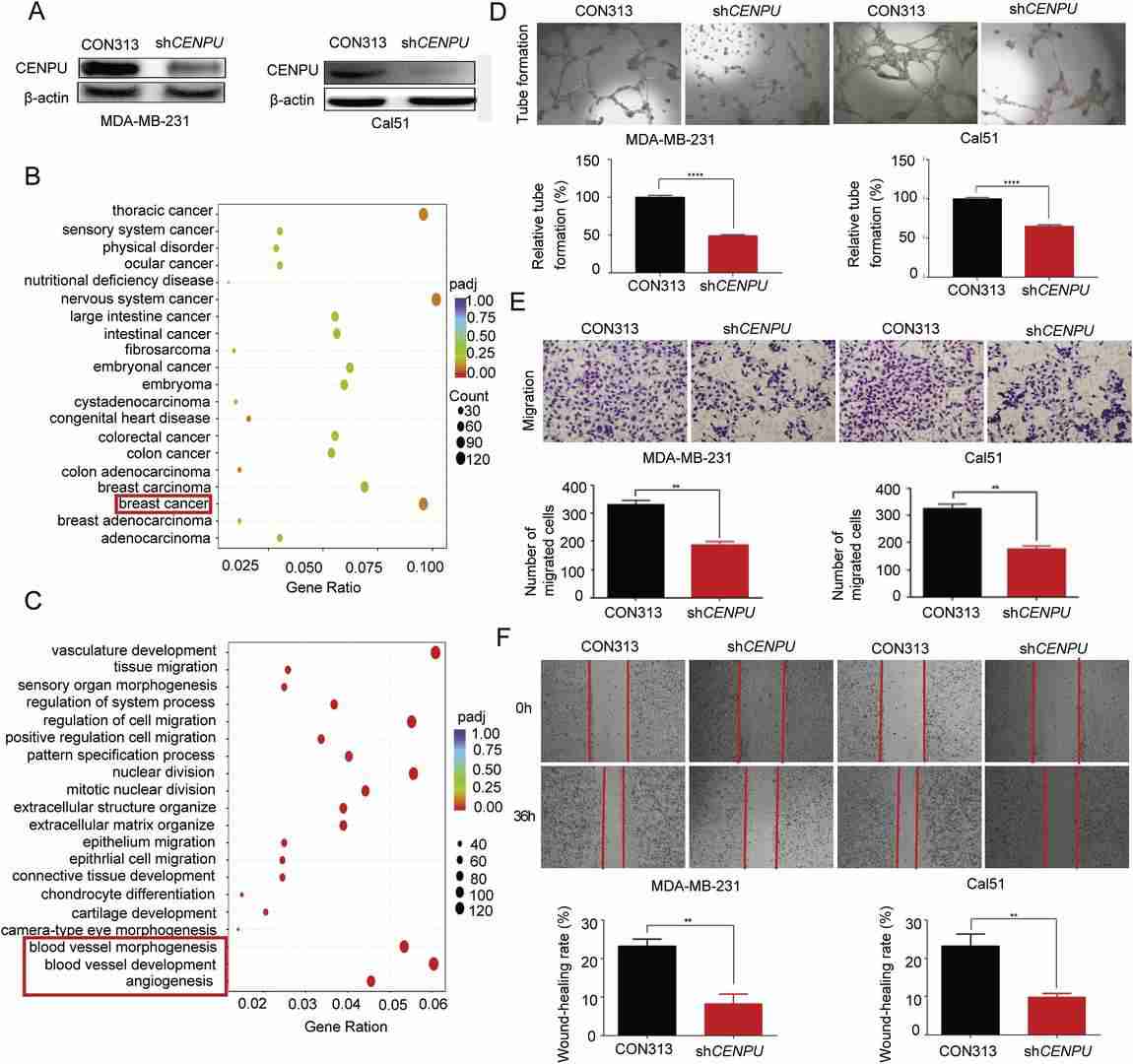 CENPU promotes triple-negative breast cancer cells angiogenesis.