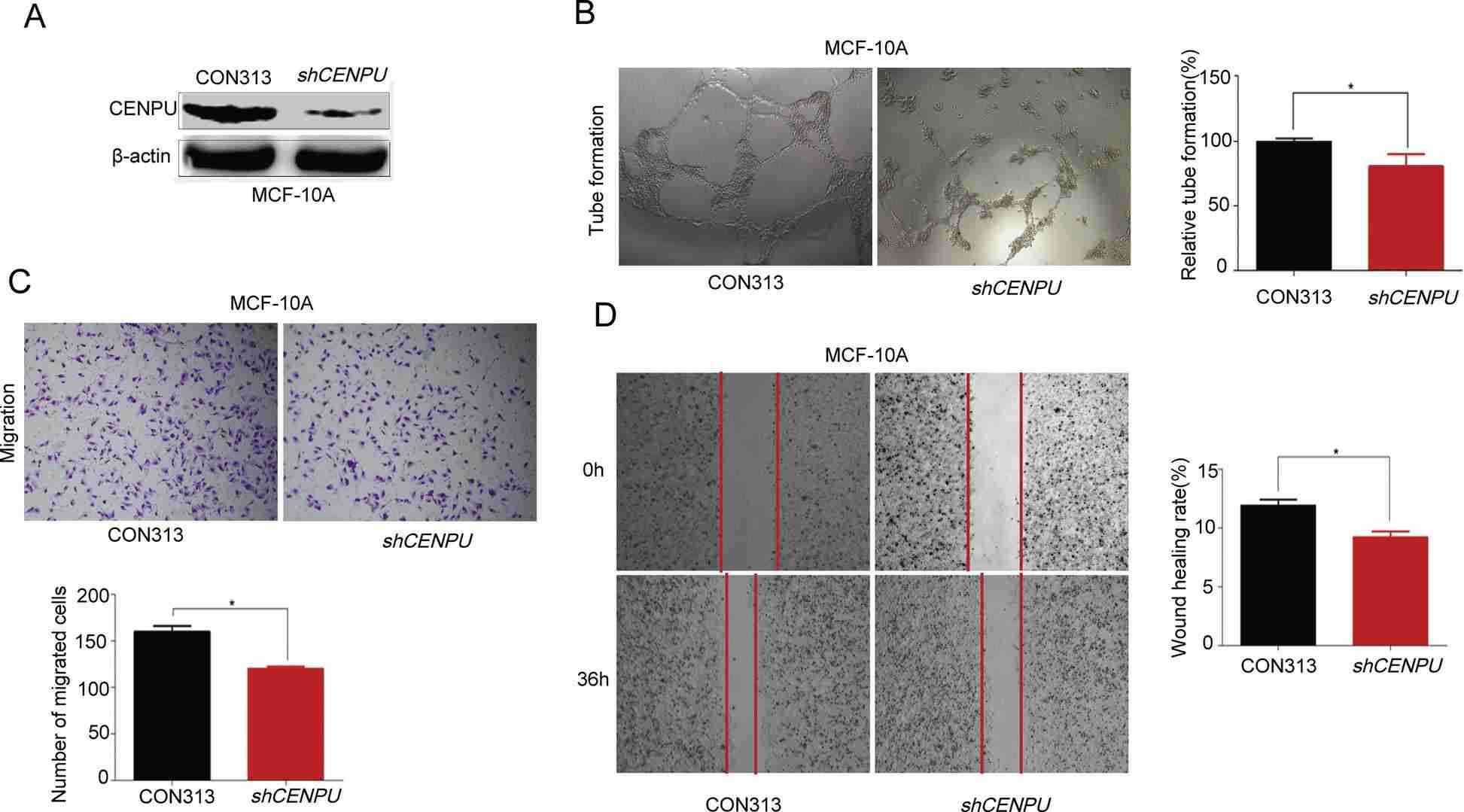 normal breast cells angiogenesis promoted by CENPU limitedly.