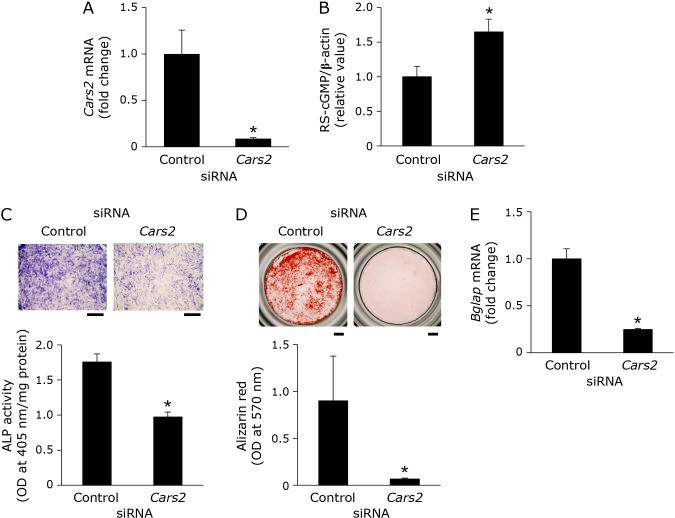 The impact of Cars2 siRNA on osteoblastic characteristics in mouse osteoblasts.