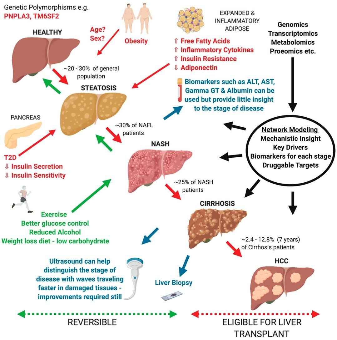 Summary of the current knowledge on the progression of Non-alcoholic Fatty Liver Disease (NAFLD) from a healthy liver to hepatocellular carcinoma (HCC).