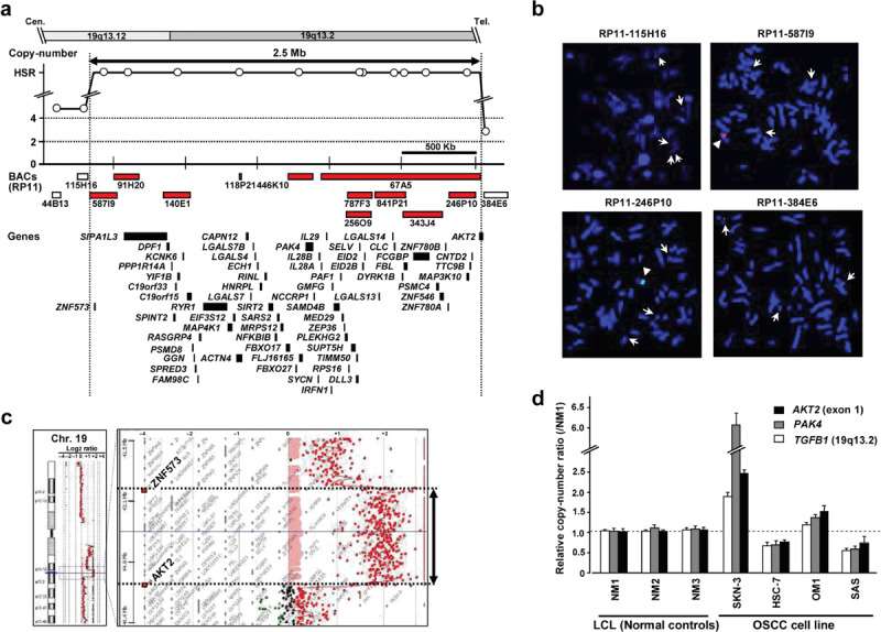 (a) Amplicon map of genomic profiles of 19q13.12-13.2 amplification in the SKN-3 cell line. (b) Representative images of the FISH analysis of metaphase chromosomes prepared from SKN-3 cells. (c) Changes in copy number around 19q13.12-13.2 in SKN-3 cells were determined using high-density oligonucleotide array-CGH. (d) Representative results of quantitative real-time genomic PCR for the AKT2 (exon1), PAK4, and control TGFB1 (19q13.2) genes.