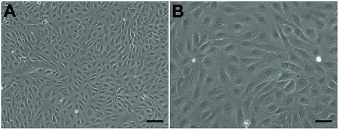 Morphology of human aortic endothelial cells.