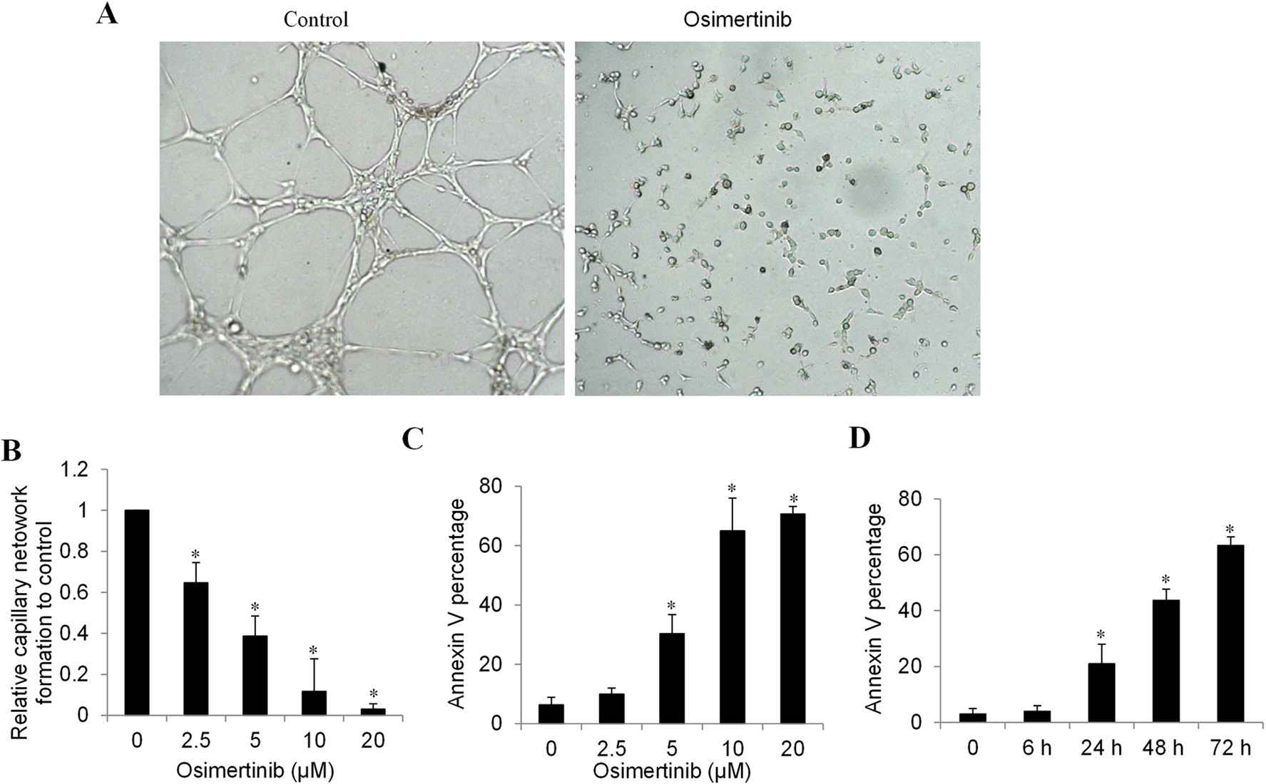 Osimertinib effectively suppresses HCC angiogenesis in primary human liver tumor-associated endothelial cells.