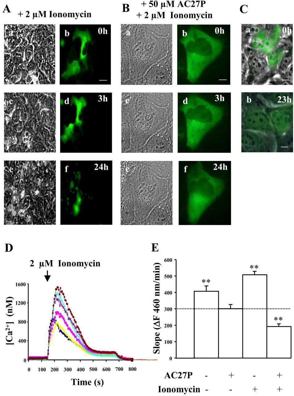 A and B show the time course of cell death after the addition of ionomycin to LCLC-103H cells overexpressing GFP either without (A) or after preincubation with 50 μm AC27P (B). C, ectopic expression of GFP does not trigger apoptosis in LCLC-103H cells. D, increase of intracellular calcium concentration upon ionomycin addition to LCLC-103H cells. E, AC27P-inhibitable Suc-LLVY-amc-hydrolyzing activity increases after the addition of 2 μm ionomycin to LCLC-103H cells.