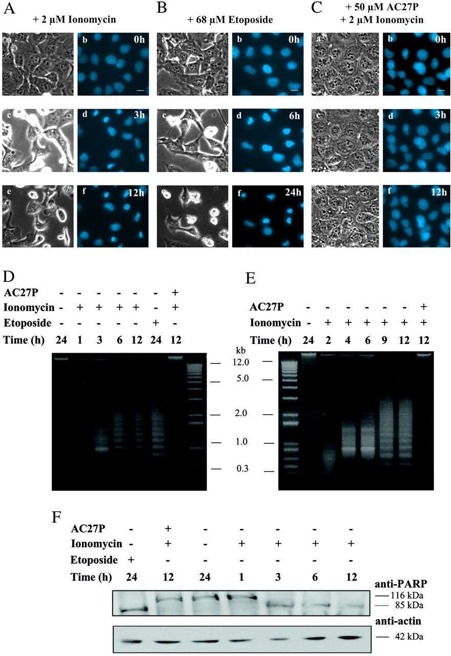 Nuclear changes in LCLC-103H cells stably overexpressing H2A.i-ECFP after treatment with 2 μmionomycin (A), 68 μm etoposide (B), or 2 μm ionomycin after preincubation with 50 μm AC27P (C). D and E, DNA ladder formation in ionomycin-treated LCLC-103H (D) and COS 7 cells (E). F, Western blots of cell lysates from LCLC-103H cells probed with anti-PARP and anti-actin antibodies.