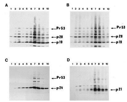 Lanes 1, 1.11 g/cm3; 2, 1.12 g/cm3; 3, 1.125 g/cm3; 4, 1.135 g/cm3; 5, 1.145 g/cm3; 6, 1.155 g/cm3; 7, 1.16 g/cm3; 8, 1.165 g/cm3; 9, 1.17 g/cm3; 10, 1.175 g/cm3. (A) Anti-p19, p28, (B) anti-p19, p28, Pr53gag, (C) anti-p24, (D) anti-p21 E. Antibodies were used at a 1:500 dilution.