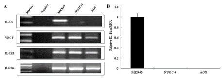 (a) PCR products stained with ethidium bromide were subjected to 1.5% agarose gel electrophoresis. β-actin served as a loading control. (b) Relative expression of IL-1α mRNA in gastric cancer cell lines compared to glyceraldehyde 3-phosphate dehydrogenase (GAPDH) was assessed using semi-quantitative reverse transcription (RT)-PCR.