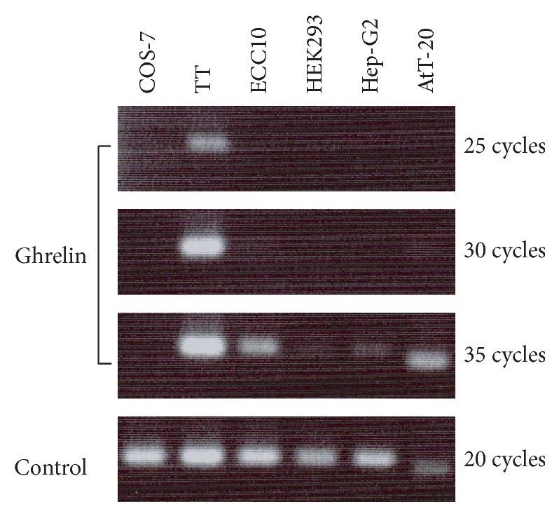 Expression of ghrelin mRNA in cultured cell lines. PCR products were separated by agarose gel electrophoresis and stained with ethidium bromide.