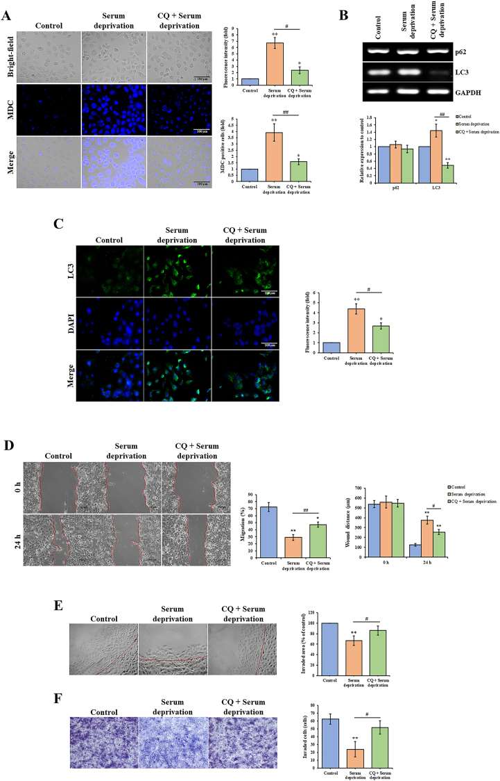 Autophagy induction impairs migration and invasion in HSC-4 cells.