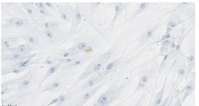 Human primary calvarial osteoblasts were analyzed for apoptosis using TUNEL staining. 