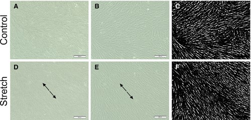 Human calvarial osteoblasts (HCObs) underwent morphological changes after 2% intermittent deformation for 5 seconds at 0.2 Hz every 60 seconds over 12 hours.