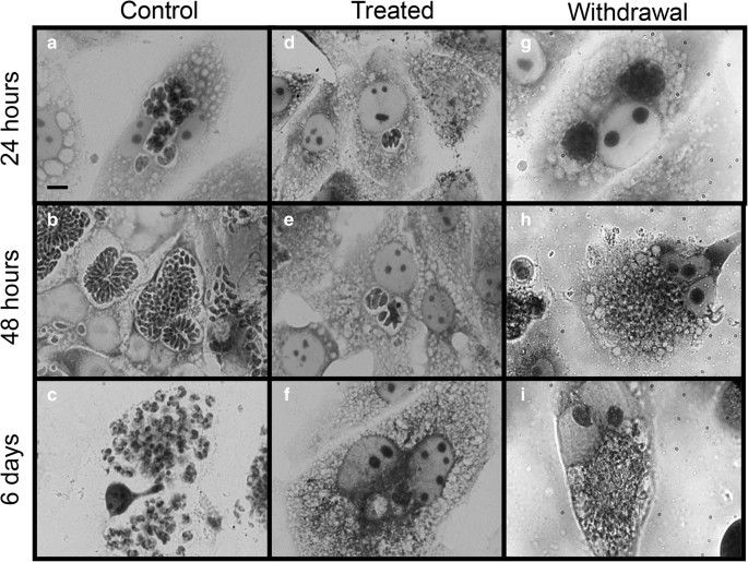 Bright-field microscopy showing LLC-MK2 cells post-infection with Toxoplasma gondii.