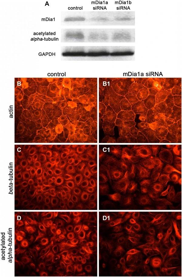 Knockdown of mDia1 using siRNA enhances microfilament and microtubule dynamics in LLC-MK2 cells.