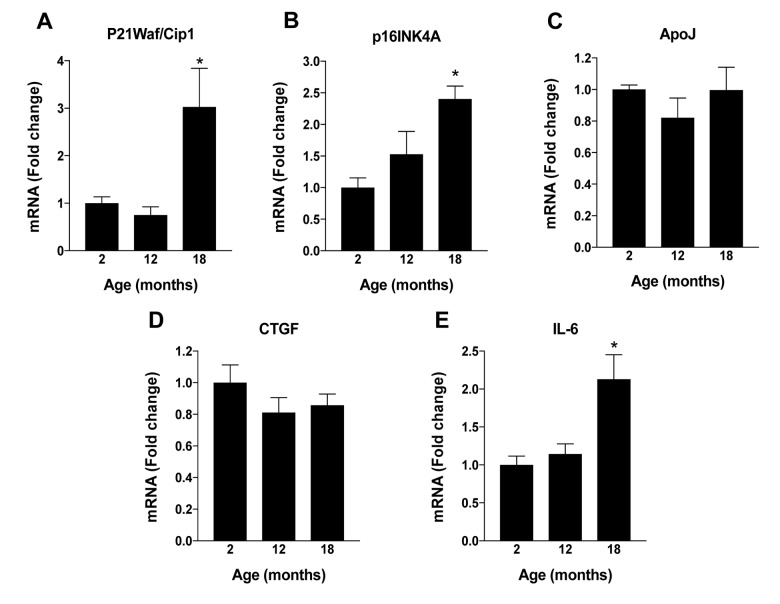 Alterations in NAD+ metabolism within RPE cells occur as mice age.