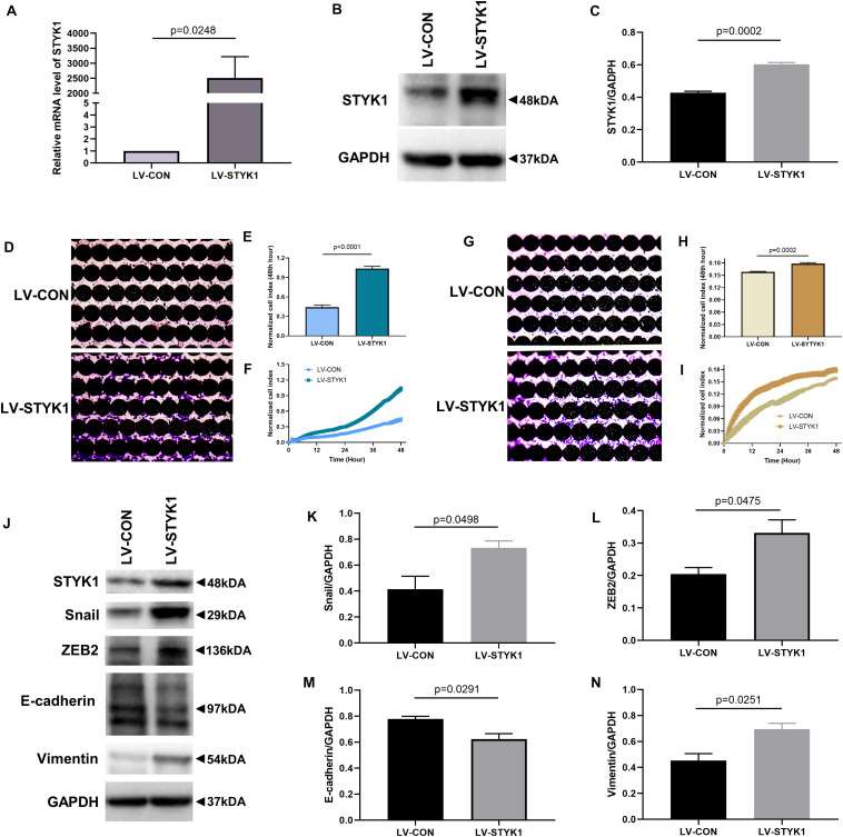 (A-C) STYK1 expression in SW-900 cells after transduction with STYK1 encoding lentiviruses. (D) Capacity for cell migration after transduction with lentiviruses encoding STYK1. (E) Normalized cell index after lentiviral STYK1 overexpression at the endpoint of RTCA. (F) Cell index curves after lentiviral STYK1 overexpression. (G-I) Cell invasion capacity after lentiviral STYK1 overexpression evaluated by RTCA and crystal violet staining. (J-N) Typical immunoblots and semiquantitative analysis of EMT biomarkers after transduction with lentiviruses encoding STYK1.