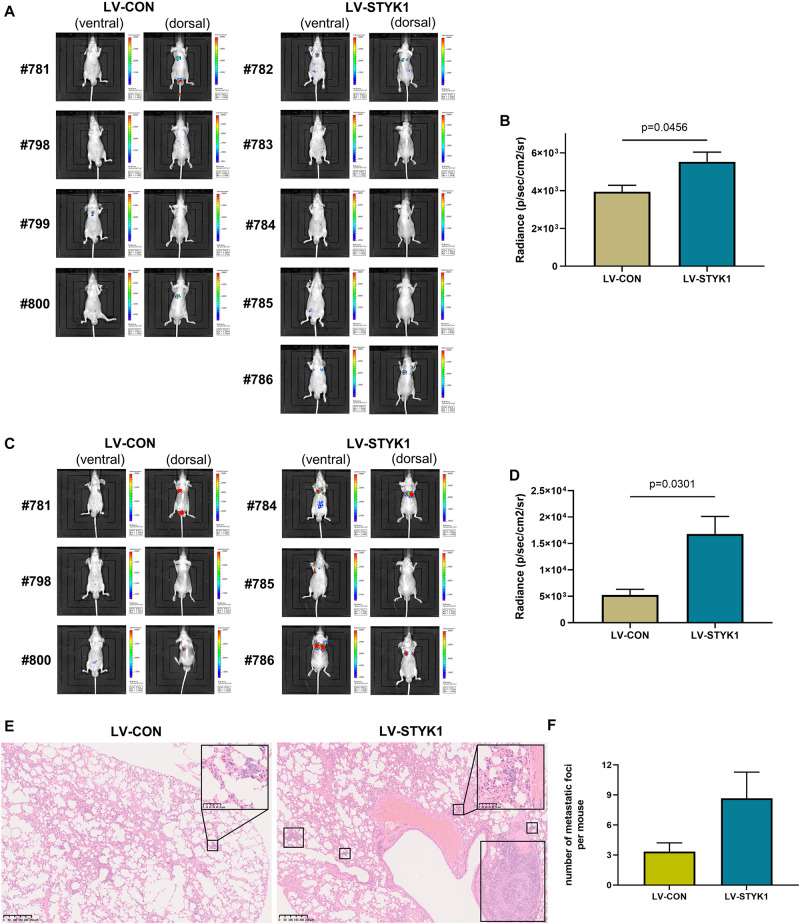 (A) Luminescent images of nude mice in 4 weeks after tail vein injection of SW-900 cells. (B) Quantitative analysis of radiance in 4 weeks after tail vein injection of SW-900 cells. (C, D) Luminescent images of nude mice and quantification of radiance in 5 weeks after tail vein injection of SW-900 cells. (E) Representative histological sections of lung metastatic lesions. (F) Comparison of the number of lung metastasis between groups.